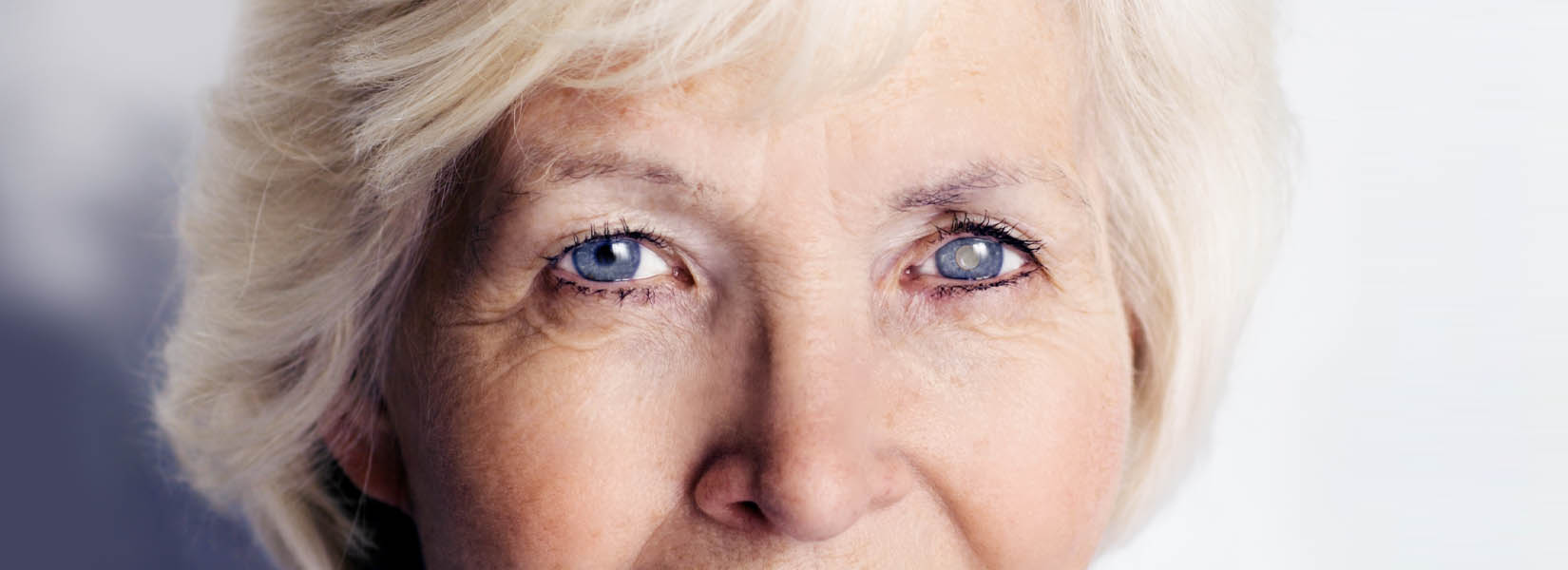 Cataract Surgery in O'Fallon