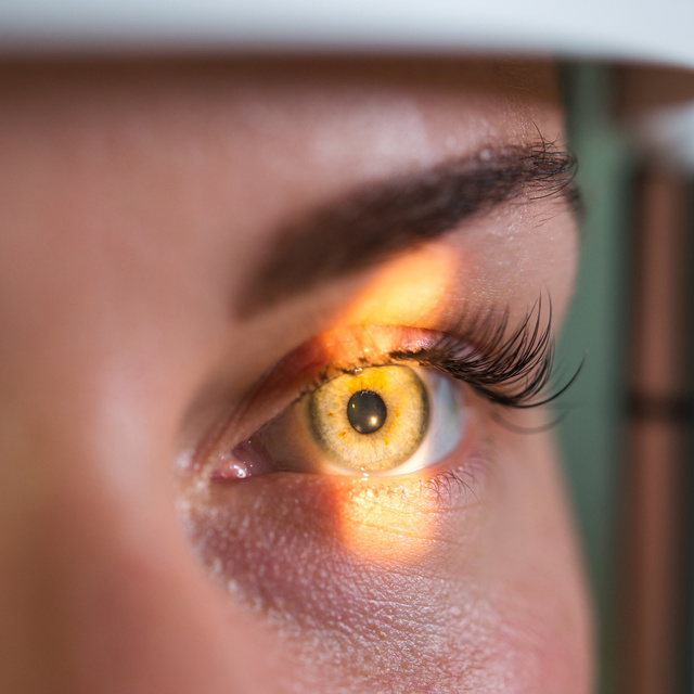 Vision Therapy in O'Fallon